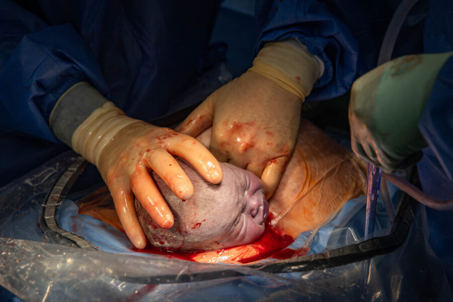 thm_june_2025_baby_c_mccloskey_csection_birth_040