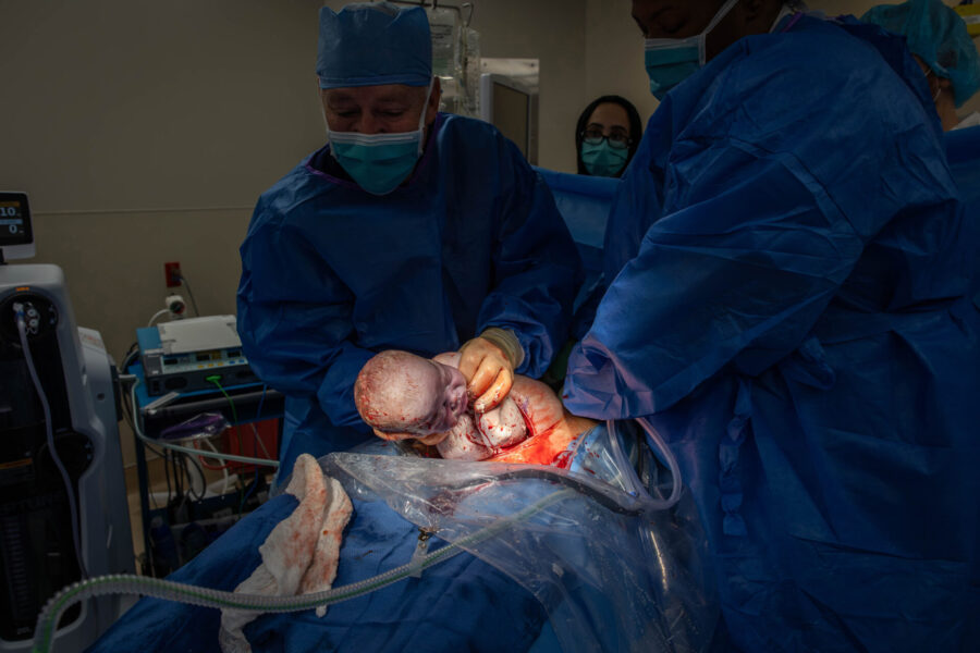 thm_june_2025_baby_c_mccloskey_csection_birth_045