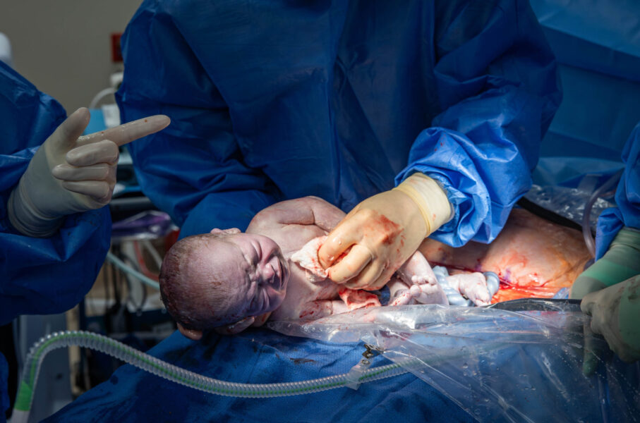 thm_june_2025_baby_c_mccloskey_csection_birth_050