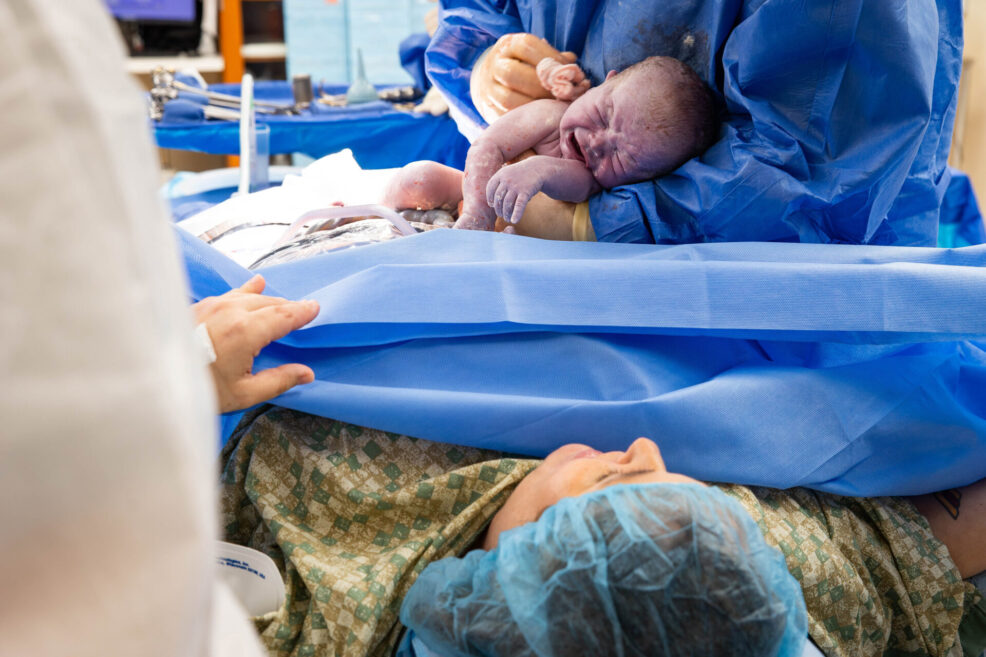 c-section birth documentary photo session in austin