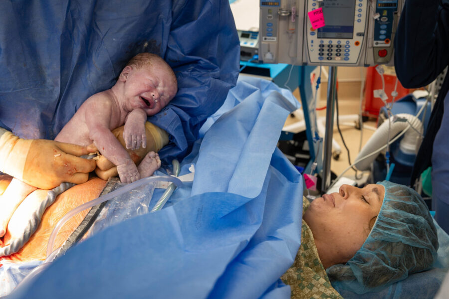 thm_june_2025_baby_c_mccloskey_csection_birth_064